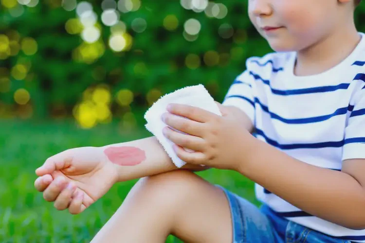 兒童手臂出現(xiàn)濕疹可不可以根治(圖1)
