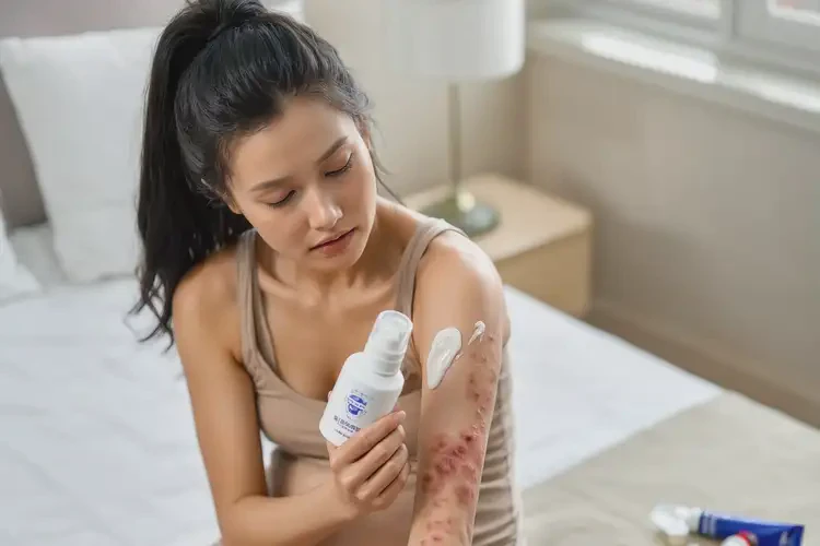 哺乳期媽媽四肢有濕疹可不可以根治(圖4)