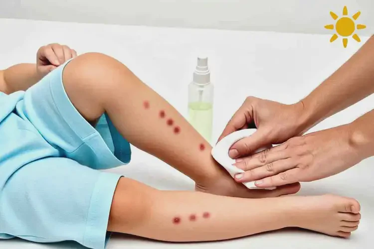 兒童小腿上偶爾起濕疹可以治好嗎(圖3)