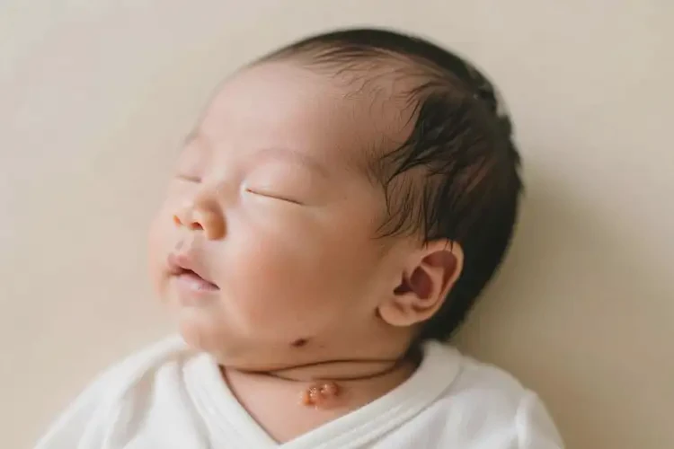 新生兒脖子上出濕疹可不可以根治(圖4)