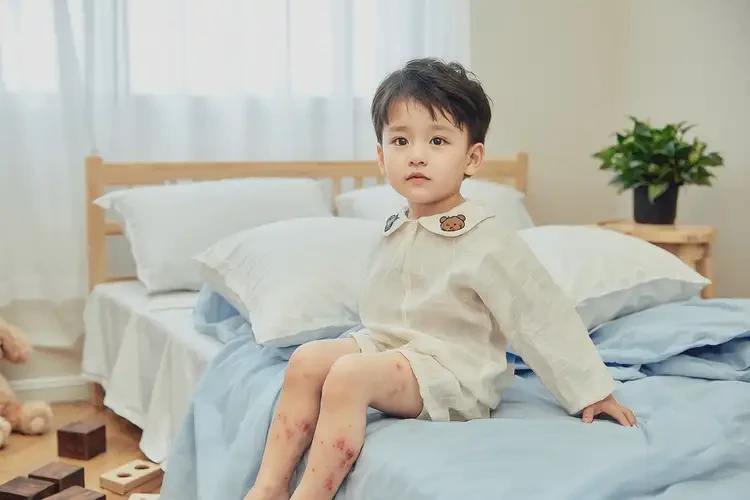 兒童大腿上偶爾長(zhǎng)濕疹可以治好嗎(圖1)