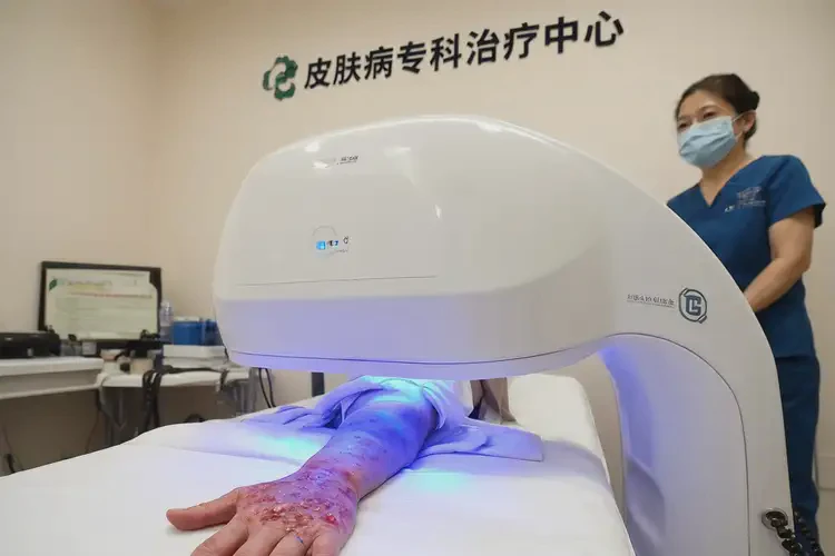 青少年手上經(jīng)常起濕疹可不可以根治(圖2)