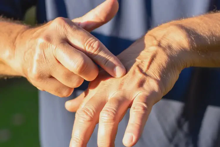 老年人手上出現(xiàn)濕疹可以治好嗎(圖1)