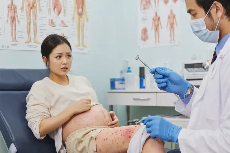 孕婦小腿上經(jīng)常長濕疹可不可以根治(圖4)