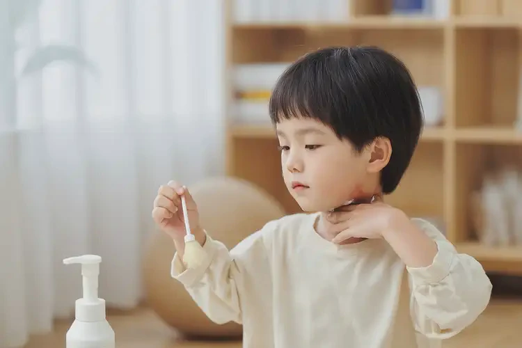 兒童脖子上偶爾起濕疹可不可以根治(圖2)