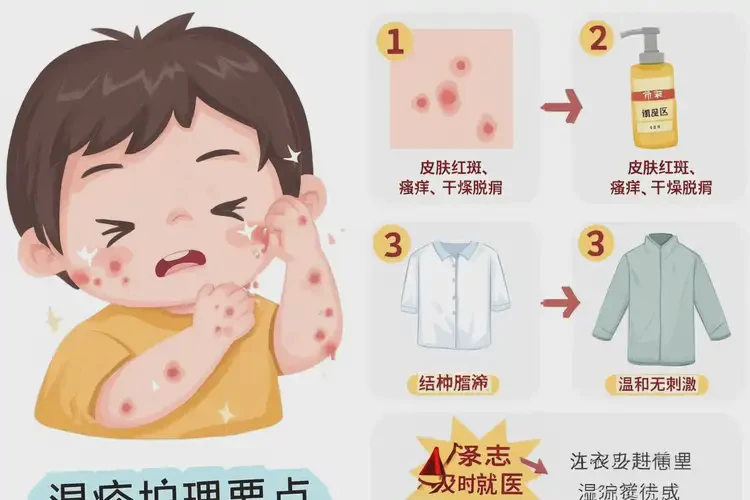 小兒四肢經(jīng)常起濕疹可以徹底自愈嗎(圖4)