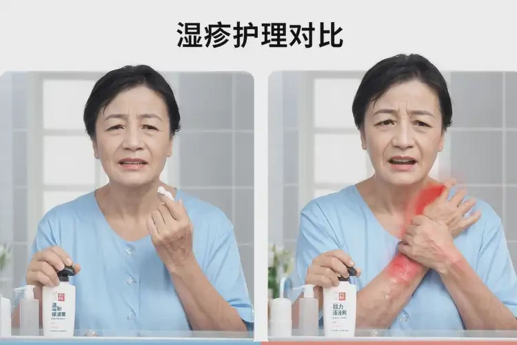 女性手臂出現(xiàn)濕疹可以治好嗎(圖2)