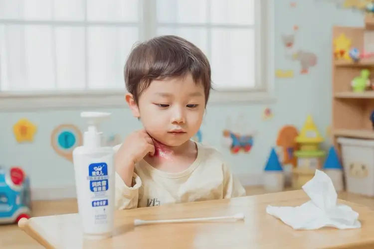 幼兒脖子經(jīng)常起濕疹可不可以根治(圖2)