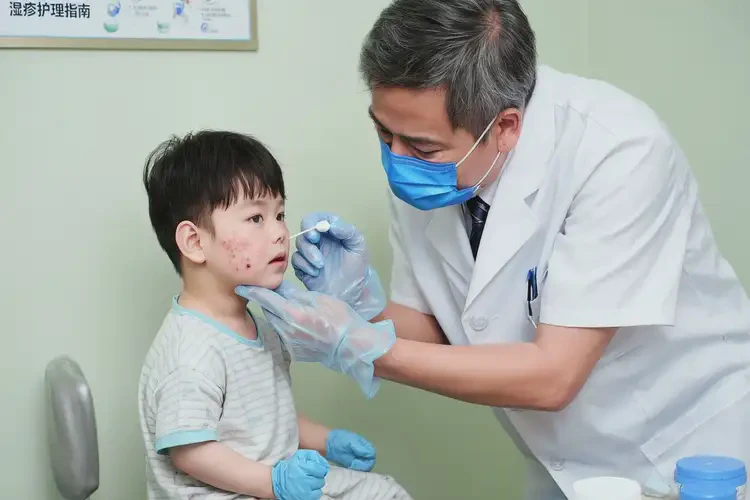 幼兒臉上偶爾長(zhǎng)濕疹可以治好嗎(圖3)