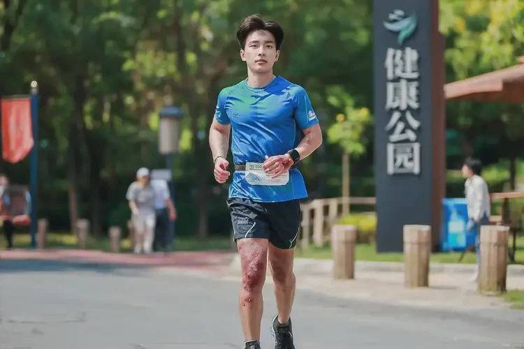 男性身上容易長(zhǎng)濕疹可以治好嗎(圖1)