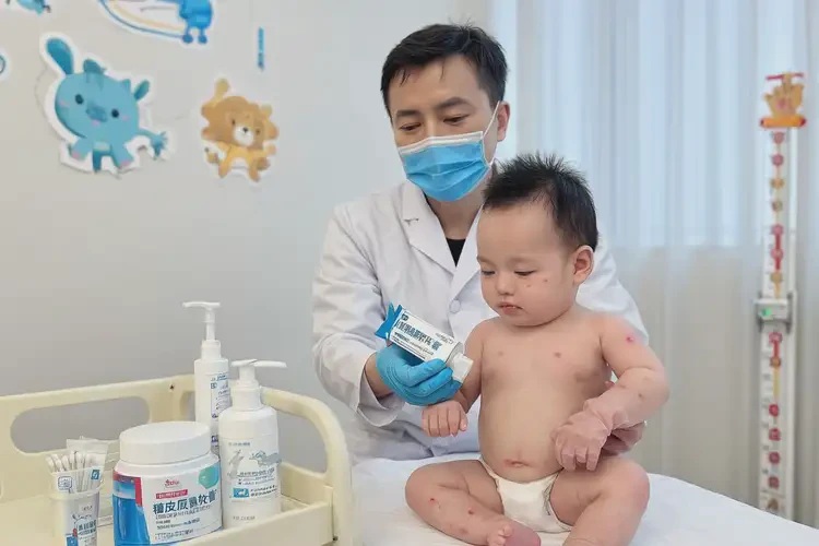 寶寶全身容易長濕疹可以治好嗎(圖2)