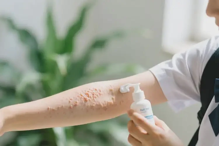 大學(xué)生手臂偶爾起濕疹可以治好嗎(圖1)