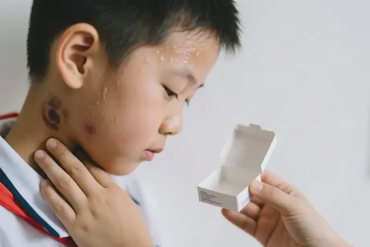 小學(xué)生脖子長(zhǎng)濕疹可不可以根治(圖2)