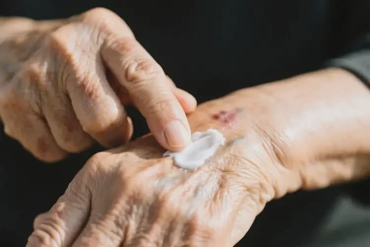 高齡老人手臂上經(jīng)常長濕疹可不可以根治(圖2)