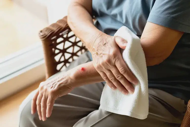 高齡老人手臂有濕疹可不可以根治(圖4)