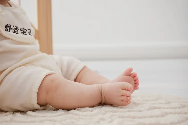 寶寶腳上出濕疹不管它會(huì)自己好嗎(圖1)