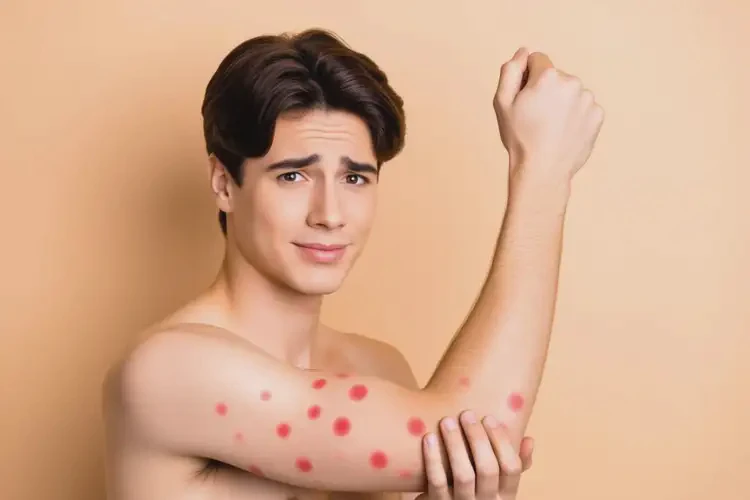 男生手臂經(jīng)常長(zhǎng)濕疹可以治好嗎(圖4)