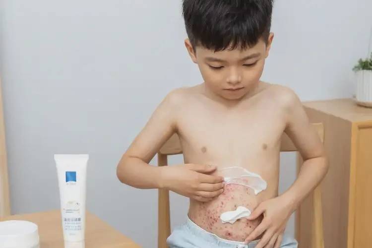 小學(xué)生肚子起濕疹可不可以根治(圖2)