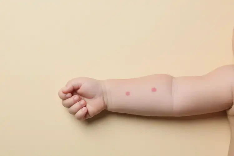 寶寶手臂上偶爾起濕疹可以治好嗎(圖2)