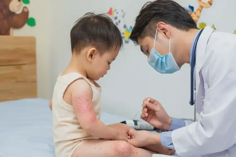 幼兒四肢經(jīng)常起濕疹可以治好嗎(圖3)