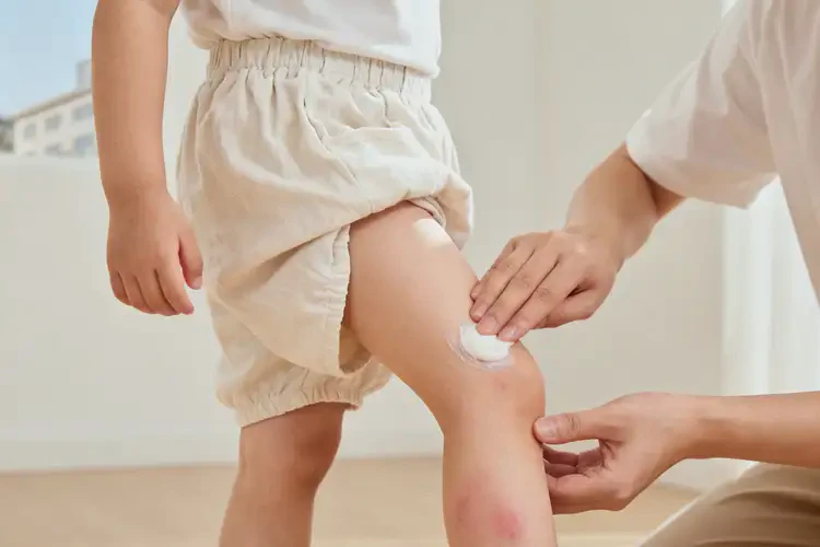 小孩小腿上出現(xiàn)濕疹能夠徹底治愈嗎(圖4)