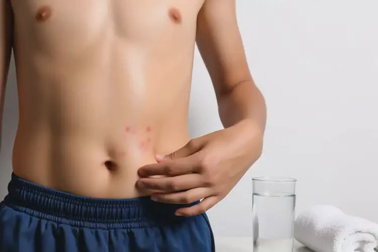 中學生肚子上偶爾長濕疹可以治好嗎(圖3)