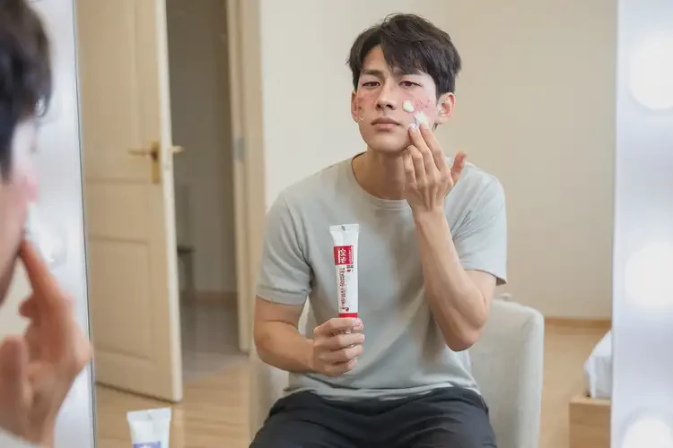 青年人面部起濕疹可以治好嗎(圖3)