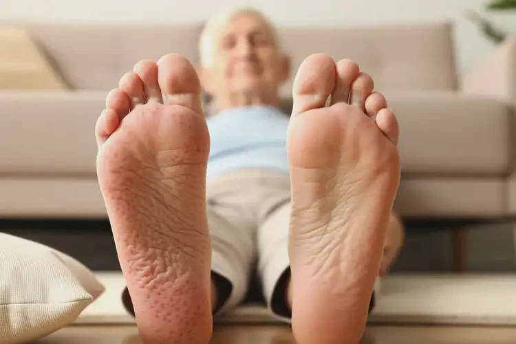 老年人腳上偶爾起濕疹可以治好嗎(圖1)