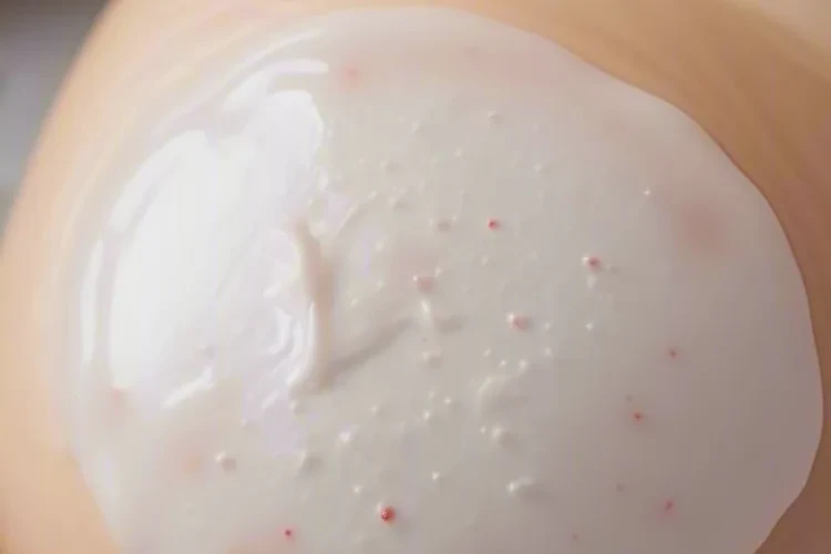 孩子肚子上容易起濕疹可以治愈嗎(圖2)