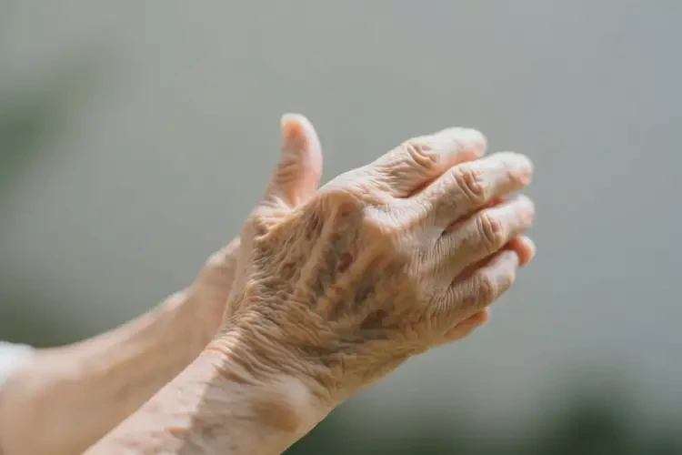 老人手臂上偶爾長濕疹可以治好嗎(圖2)