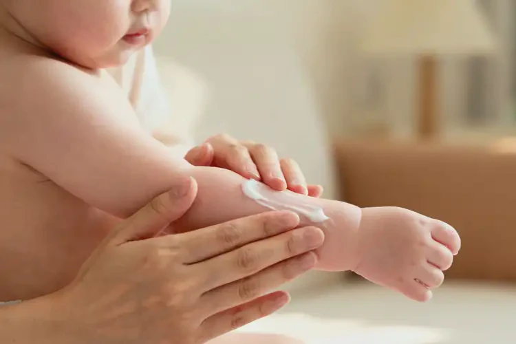 嬰幼兒四肢容易起濕疹可以治好嗎(圖1)