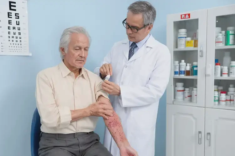 老人身上經(jīng)常長(zhǎng)濕疹可以治好嗎(圖3)