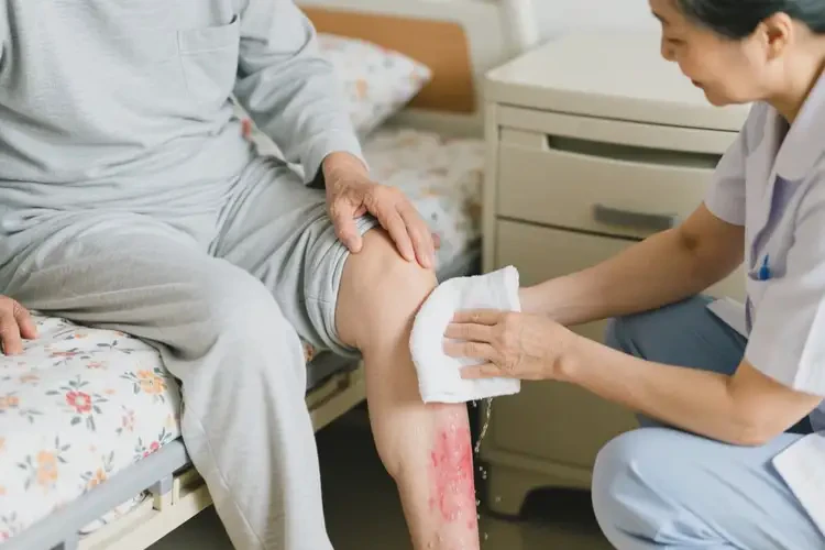 高齡老人四肢經(jīng)常長(zhǎng)濕疹可不可以根治(圖3)