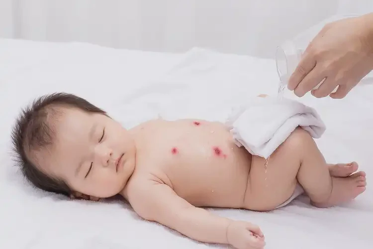 嬰兒四肢經(jīng)常起濕疹可以治好嗎(圖1)