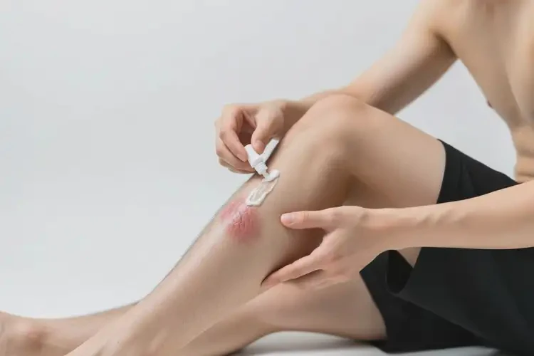 男生小腿上出现湿疹可以治好吗(图3)