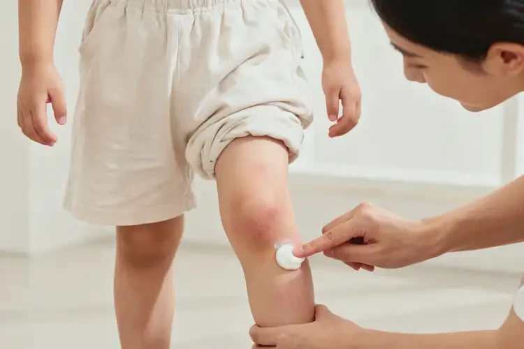 小孩小腿上出現(xiàn)濕疹能夠徹底治愈嗎(圖3)