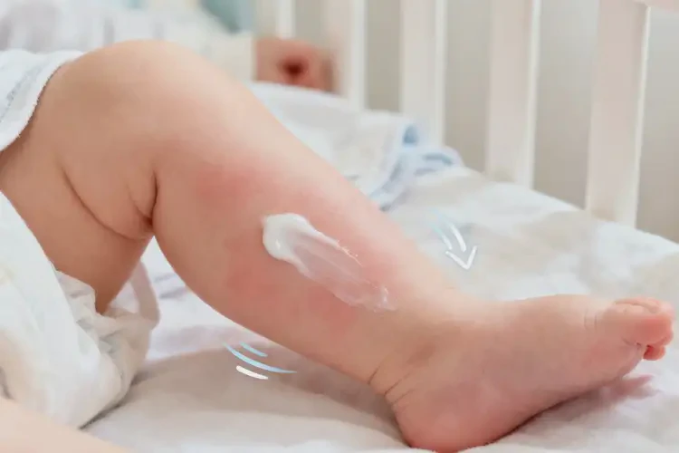 嬰兒小腿上偶爾起濕疹可以治好嗎(圖3)