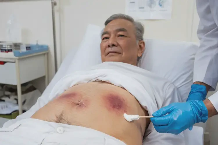 老人肚子上長(zhǎng)濕疹可以治好嗎(圖3)