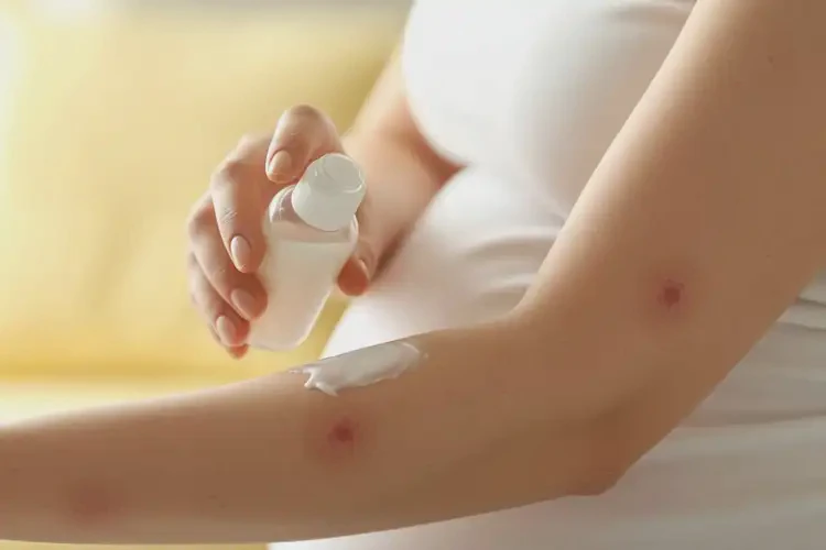 孕婦身上有濕疹可以治好嗎(圖3)