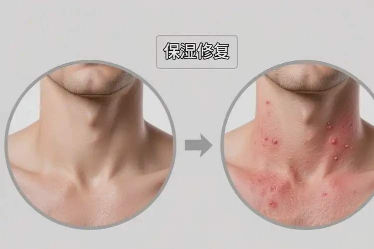 男性脖子出现湿疹可以治好吗(图1)