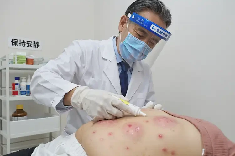 產(chǎn)婦肚子出濕疹可以治好嗎(圖3)