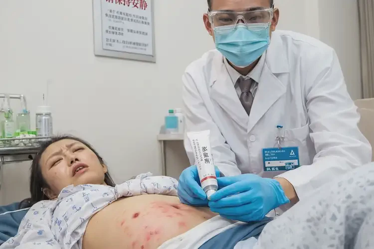 產(chǎn)婦肚子出濕疹可以治好嗎(圖2)