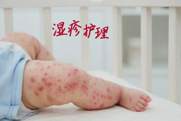 嬰兒四肢出濕疹可以治好嗎(圖3)