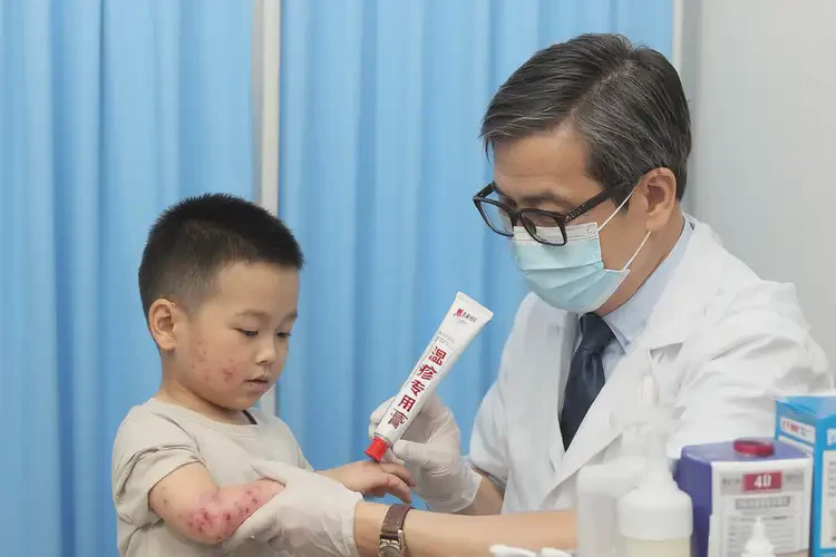 少儿身上有湿疹可以治好吗(图4)