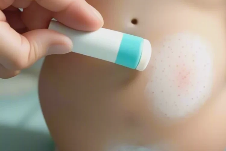 婴幼儿屁股偶尔起湿疹可以治愈吗(图2)