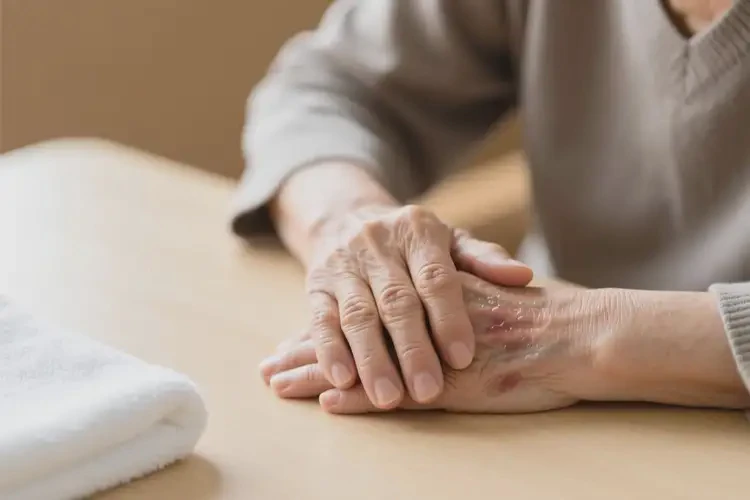 高齡老人手上長濕疹可不可以根治(圖2)