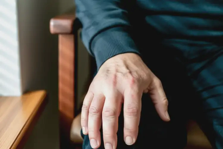 老人身上偶爾長濕疹可以治好嗎(圖4)