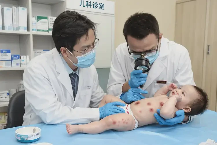 嬰兒四肢經(jīng)常起濕疹可以治好嗎(圖2)