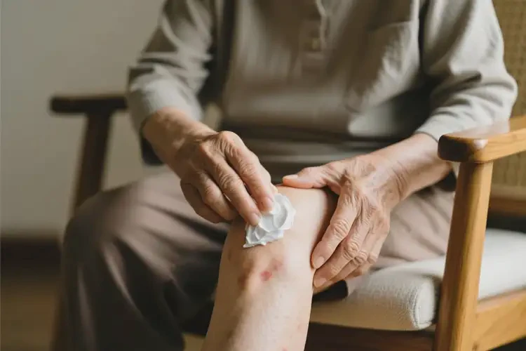 老年人大腿偶爾起濕疹可以治好嗎(圖3)