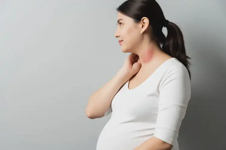 孕婦脖子上有濕疹可以治好嗎(圖3)